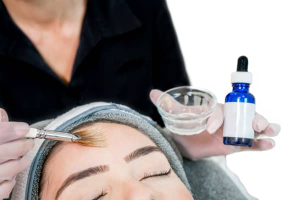 Chemical Peel Skin Care