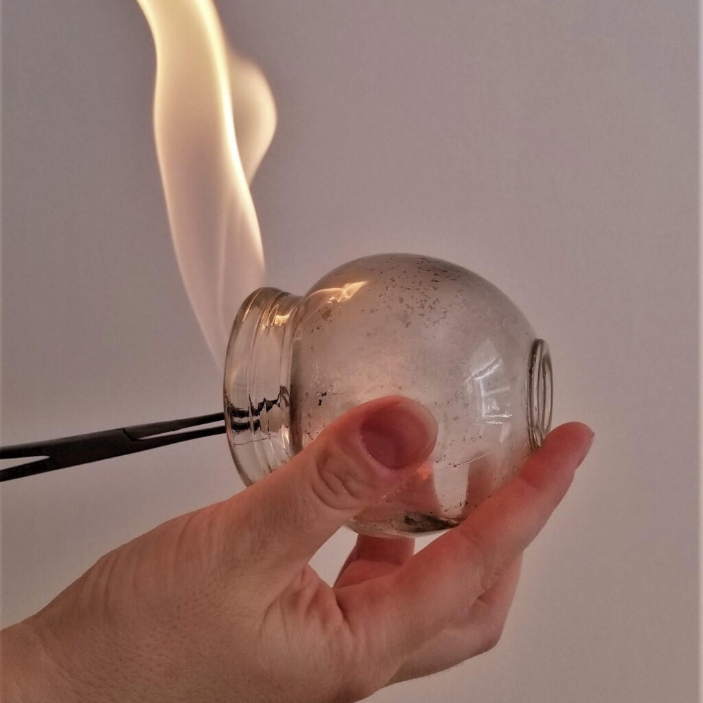 Fire Cupping